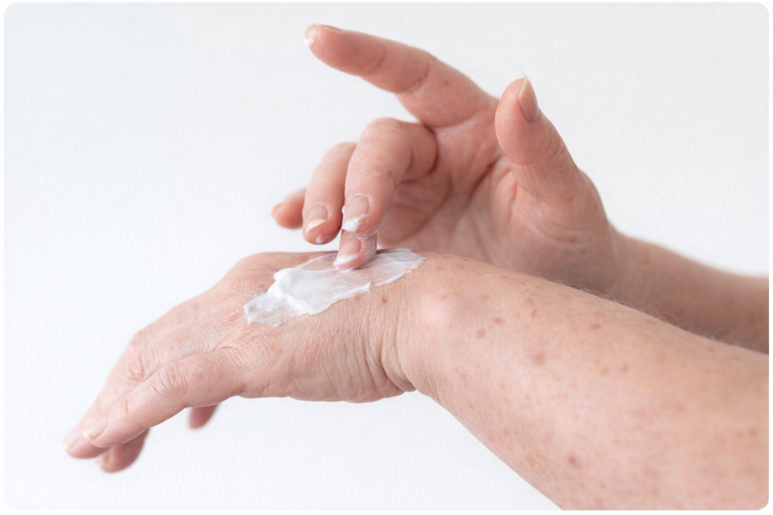 Topical 101: A Guide to Complex Dermatology Formulation Development